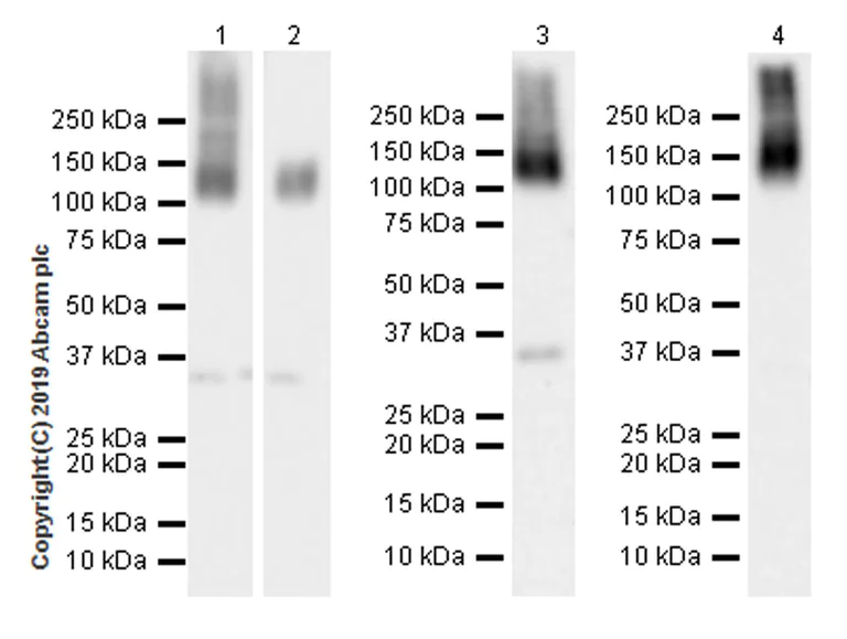 Western blot - Anti-ANO6 antibody [EPR20910-105] (AB234422)