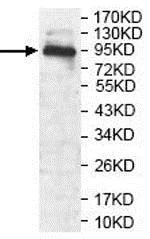 Western blot - Anti-ANO9 antibody (AB140087)