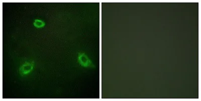 Immunocytochemistry/ Immunofluorescence - Anti-Anoctamin 7 antibody - C-terminal (AB196675)