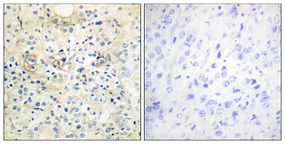 Immunohistochemistry (Formalin/PFA-fixed paraffin-embedded sections) - Anti-Anoctamin 7 antibody - C-terminal (AB196675)