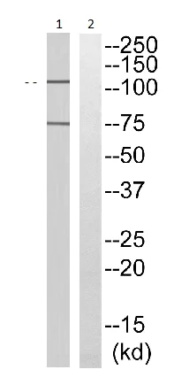 Western blot - Anti-Anoctamin 7 antibody - C-terminal (AB196675)