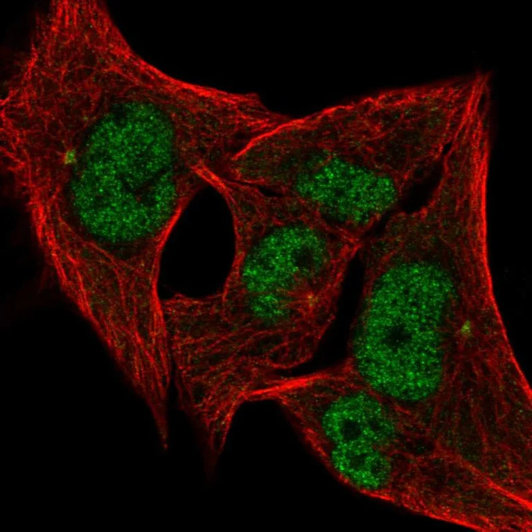 Immunocytochemistry/ Immunofluorescence - Anti-ANP32A Antibody (AB327267)