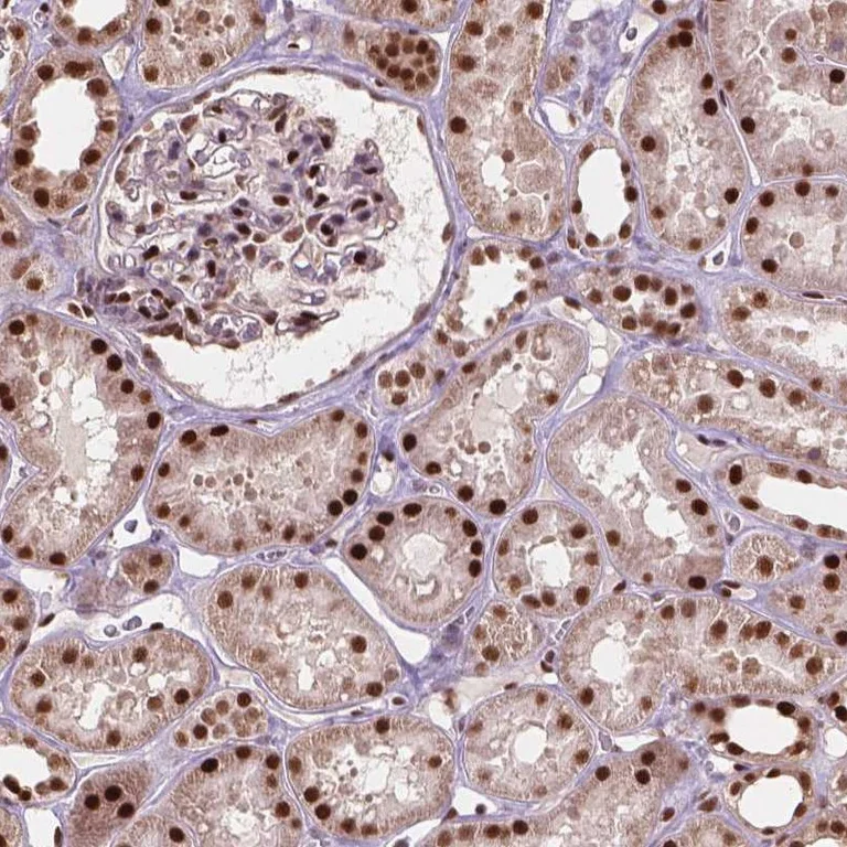 Immunohistochemistry (Formalin/PFA-fixed paraffin-embedded sections) - Anti-ANP32A Antibody (AB327267)