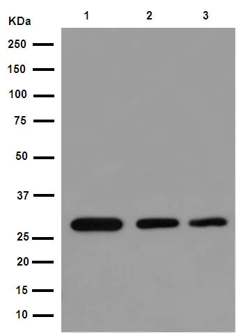 Western blot - Anti-ANP32C/PP32R1 antibody [EPR13354-70R] - BSA and Azide free (AB251006)