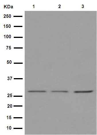 Western blot - Anti-ANP32C/PP32R1 antibody [EPR13354-70R] - BSA and Azide free (AB251006)