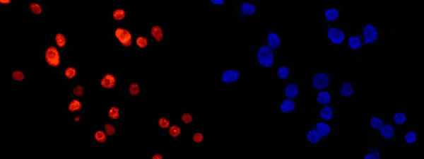 Immunocytochemistry/ Immunofluorescence - Anti-ANP32C/PP32R1 antibody [EPR13354] - BSA and Azide free (AB250456)