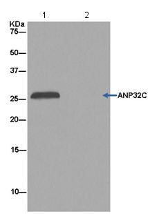 Immunoprecipitation - Anti-ANP32C/PP32R1 antibody [EPR13354] - BSA and Azide free (AB250456), expandable thumbnail