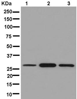 Western blot - Anti-ANP32C/PP32R1 antibody [EPR13354] - BSA and Azide free (AB250456), expandable thumbnail