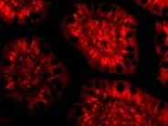 Immunocytochemistry - Anti-ANP32E antibody (AB5993)