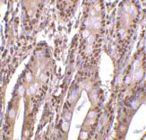 Immunohistochemistry (Formalin/PFA-fixed paraffin-embedded sections) - Anti-ANP32E antibody (AB5993)