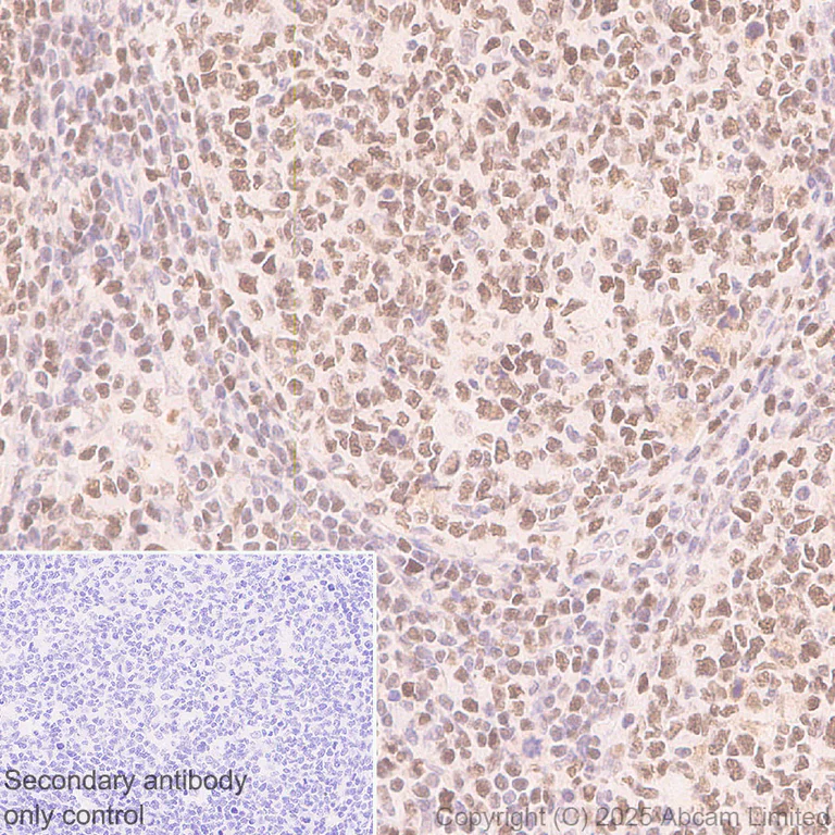 Immunohistochemistry (Formalin/PFA-fixed paraffin-embedded sections) - Anti-ANP32E antibody [EPR29188-30] (AB324142)