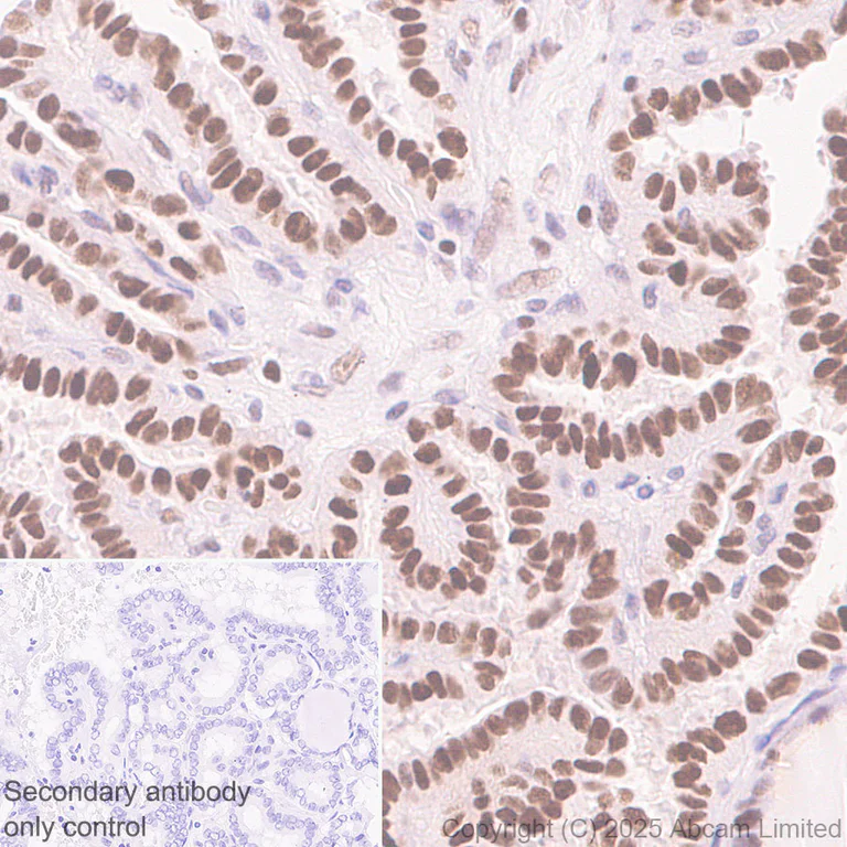 Immunohistochemistry (Formalin/PFA-fixed paraffin-embedded sections) - Anti-ANP32E antibody [EPR29188-30] (AB324142)