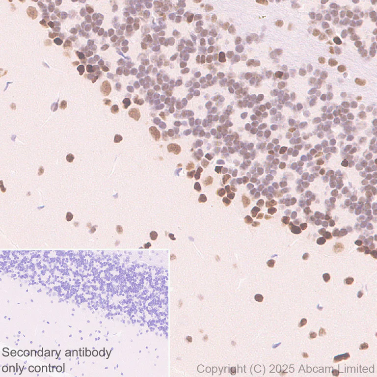 Immunohistochemistry (Formalin/PFA-fixed paraffin-embedded sections) - Anti-ANP32E antibody [EPR29188-30] (AB324142)