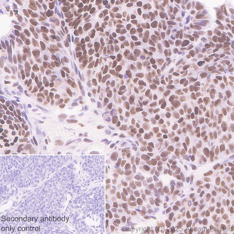 Immunohistochemistry (Formalin/PFA-fixed paraffin-embedded sections) - Anti-ANP32E antibody [EPR29188-30] (AB324142)
