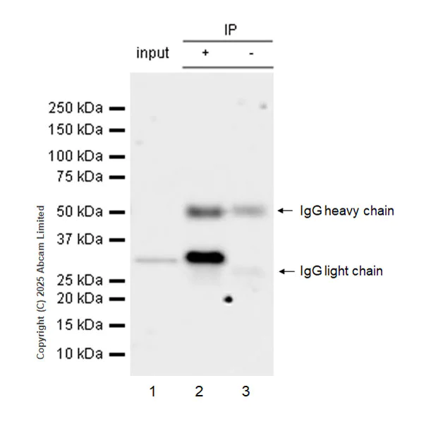 Immunoprecipitation - Anti-ANP32E antibody [EPR29188-30] (AB324142)