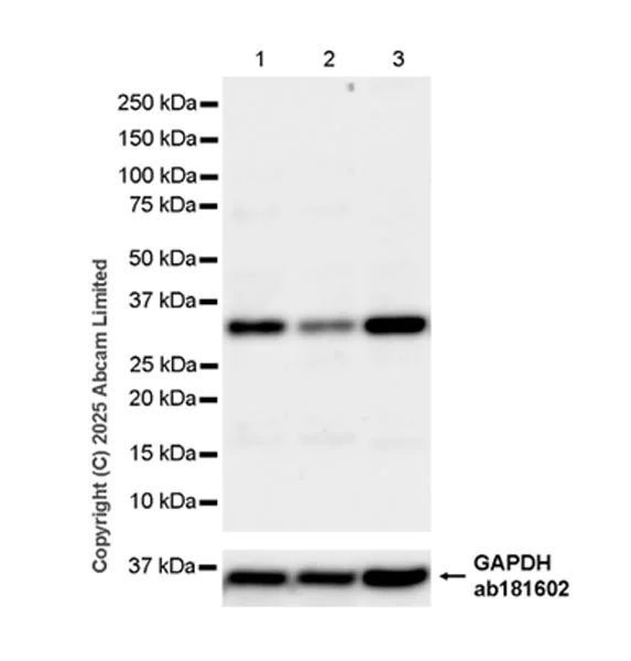 Western blot - Anti-ANP32E antibody [EPR29188-30] (AB324142)