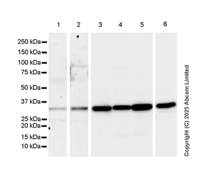 Western blot - Anti-ANP32E antibody [EPR29188-30] (AB324142)