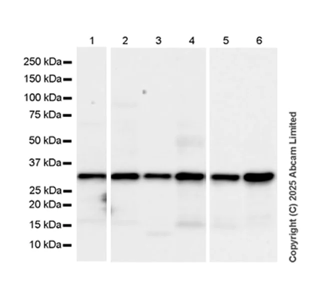 Western blot - Anti-ANP32E antibody [EPR29188-30] (AB324142)