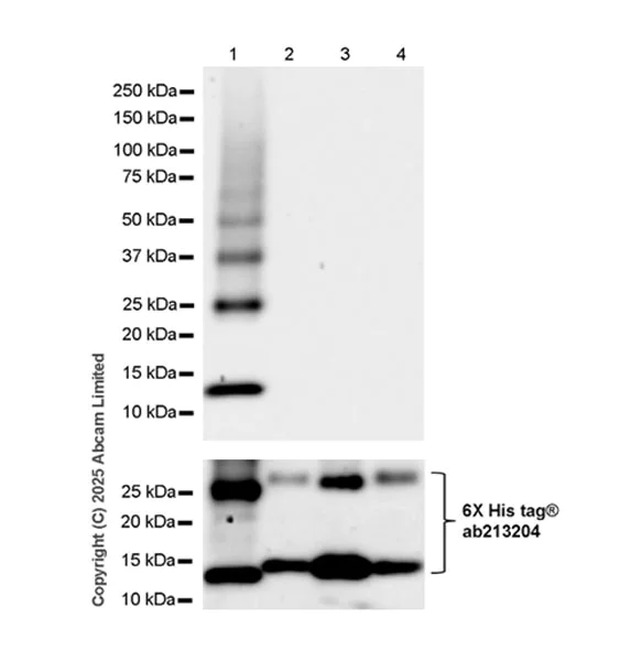 Western blot - Anti-ANP32E antibody [EPR29188-30] (AB324142)