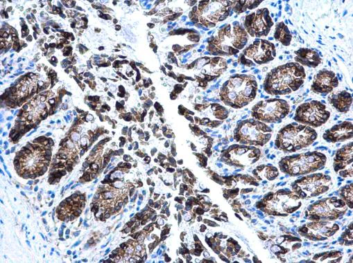 Immunohistochemistry (Formalin/PFA-fixed paraffin-embedded sections) - Anti-Anterior Gradient 2 antibody (AB227584)