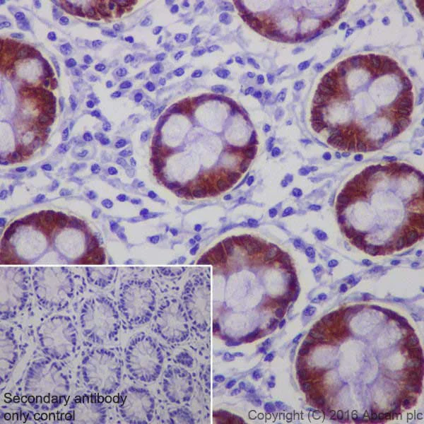 Immunohistochemistry (Formalin/PFA-fixed paraffin-embedded sections) - Anti-Anterior Gradient 2 antibody [EPR20164-278] (AB209224)