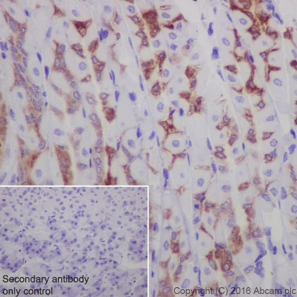 Immunohistochemistry (Formalin/PFA-fixed paraffin-embedded sections) - Anti-Anterior Gradient 2 antibody [EPR20164-278] (AB209224)
