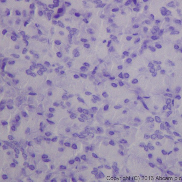 Immunohistochemistry (Formalin/PFA-fixed paraffin-embedded sections) - Anti-Anterior Gradient 2 antibody [EPR20164-278] (AB209224)
