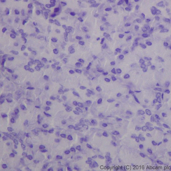 Immunohistochemistry (Formalin/PFA-fixed paraffin-embedded sections) - Anti-Anterior Gradient 2 antibody [EPR20164-278] (AB209224)