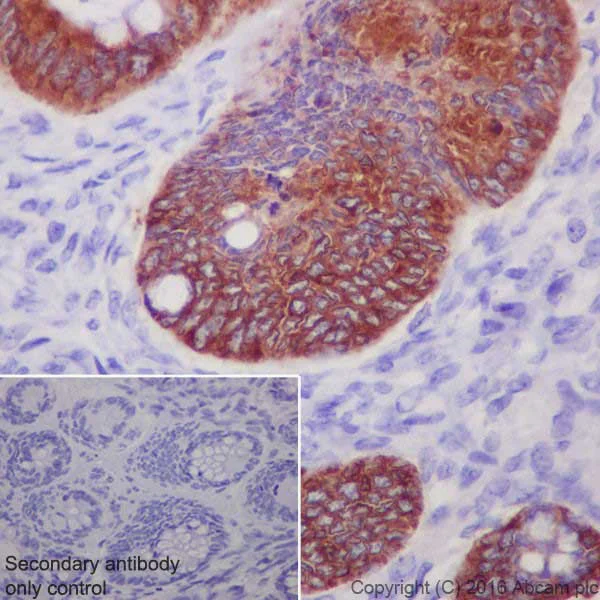 Immunohistochemistry (Formalin/PFA-fixed paraffin-embedded sections) - Anti-Anterior Gradient 2 antibody [EPR20164-278] - BSA and Azide free (AB251500)