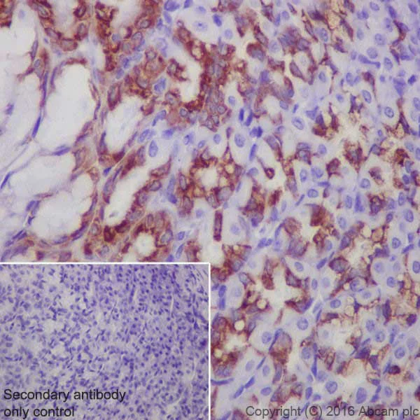 Immunohistochemistry (Formalin/PFA-fixed paraffin-embedded sections) - Anti-Anterior Gradient 2 antibody [EPR20164-278] - BSA and Azide free (AB251500)