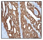 Immunohistochemistry (Formalin/PFA-fixed paraffin-embedded sections) - Anti-Anterior Gradient 2 antibody [EPR3278] (AB76473)