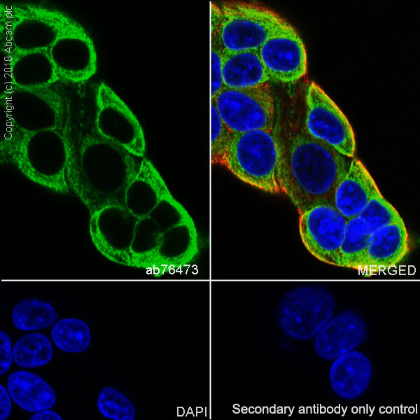 Immunocytochemistry/ Immunofluorescence - Anti-Anterior Gradient 2 antibody [EPR3278] - BSA and Azide free (AB181829)