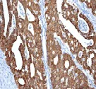 Immunohistochemistry (Formalin/PFA-fixed paraffin-embedded sections) - Anti-Anterior Gradient 2 antibody [EPR3278] - BSA and Azide free (AB181829)