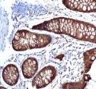 Immunohistochemistry (Formalin/PFA-fixed paraffin-embedded sections) - Anti-Anterior Gradient 2 antibody [EPR3278] - BSA and Azide free (AB181829)