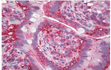 Immunohistochemistry (Formalin/PFA-fixed paraffin-embedded sections) - Anti-Anterior Gradient 2 antibody [IMG10E2] (AB189361)