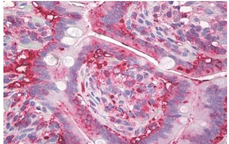 Immunohistochemistry (Formalin/PFA-fixed paraffin-embedded sections) - Anti-Anterior Gradient 2 antibody [IMG10E2] (AB189361)