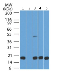 Western blot - Anti-Anterior Gradient 2 antibody [IMG10E2] (AB189361)
