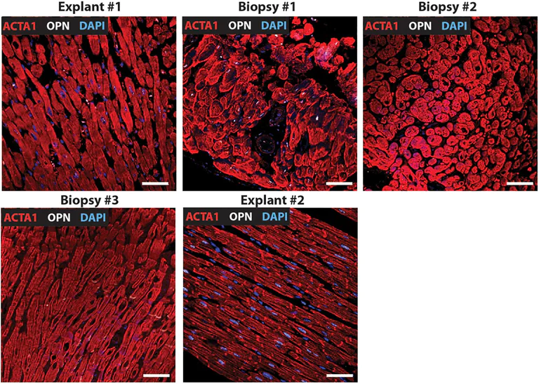 Immunohistochemistry (Formalin/PFA-fixed paraffin-embedded sections) - Antigen Retrieval Buffer (100X Citrate Buffer) (AB93678)