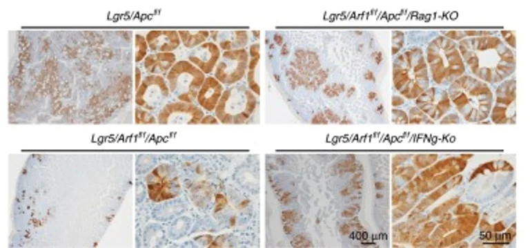 Immunohistochemistry (Formalin/PFA-fixed paraffin-embedded sections) - Antigen Retrieval Buffer (100X Citrate Buffer) (AB93678)