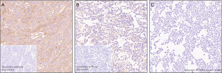 Immunohistochemistry (Formalin/PFA-fixed paraffin-embedded sections) - Antigen Retrieval Buffer (100X Citrate Buffer) (AB93678)