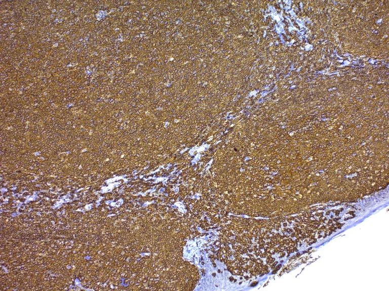 Immunohistochemistry (Formalin/PFA-fixed paraffin-embedded sections) - Antigen Retrieval Buffer (100X EDTA Buffer, pH 8.0) (AB93680)