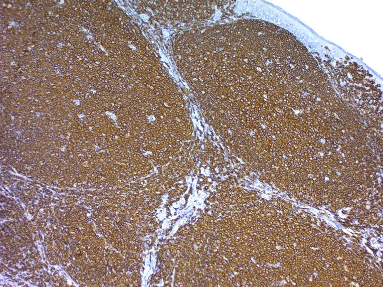 Immunohistochemistry (Formalin/PFA-fixed paraffin-embedded sections) - Antigen Retrieval Buffer (100X Tris Buffer, pH 10.0) (AB93682)