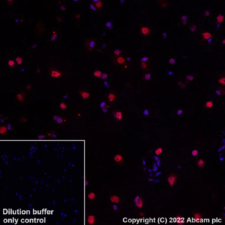Immunohistochemistry (Formalin/PFA-fixed paraffin-embedded sections) - Antigen Retrieval Buffer (100X Tris-EDTA Buffer, pH 9.0) (AB93684)