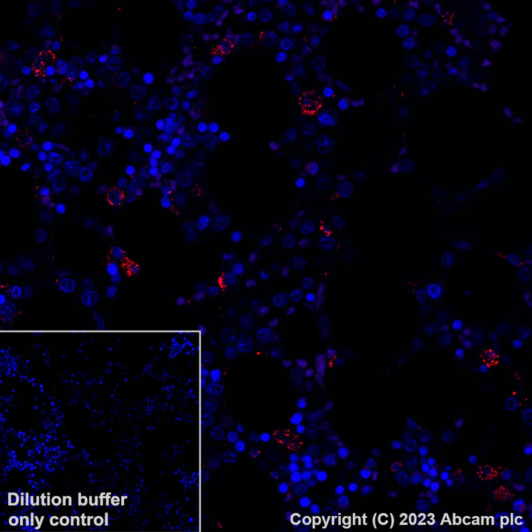 Immunohistochemistry (Formalin/PFA-fixed paraffin-embedded sections) - Antigen Retrieval Buffer (100X Tris-EDTA Buffer, pH 9.0) (AB93684)