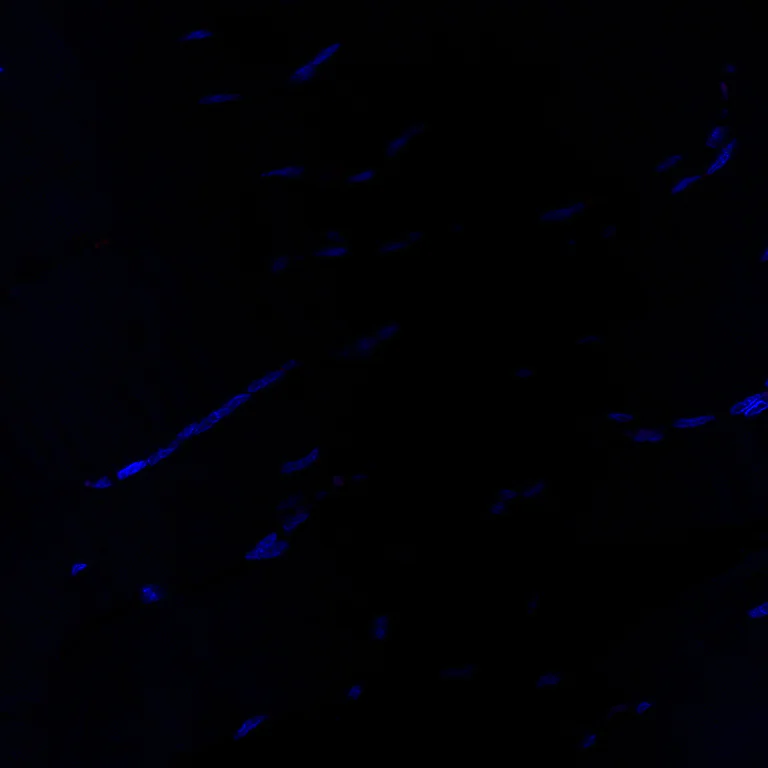 Immunohistochemistry (Formalin/PFA-fixed paraffin-embedded sections) - Antigen Retrieval Buffer (100X Tris-EDTA Buffer, pH 9.0) (AB93684)