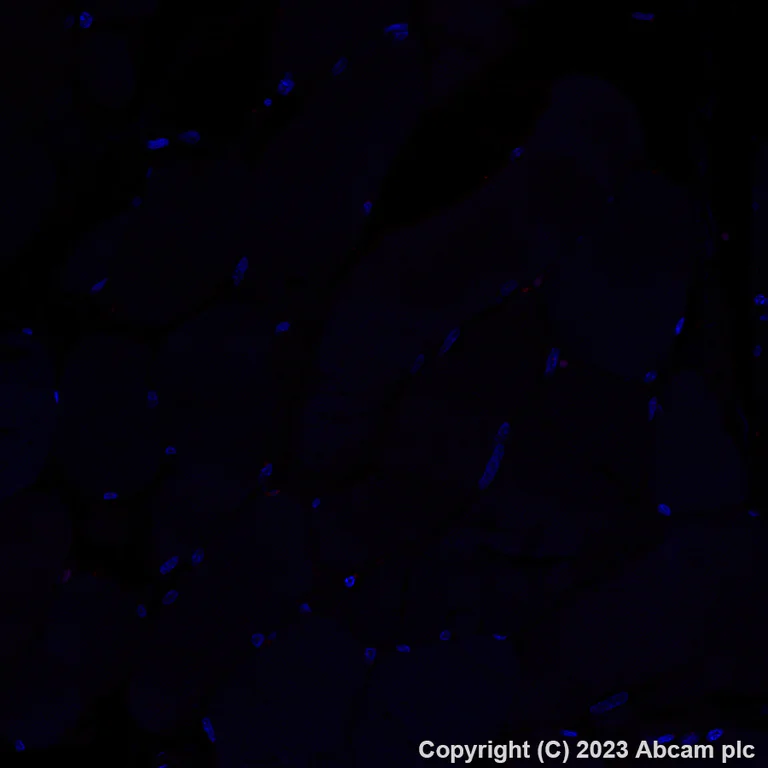 Immunohistochemistry (Formalin/PFA-fixed paraffin-embedded sections) - Antigen Retrieval Buffer (100X Tris-EDTA Buffer, pH 9.0) (AB93684)
