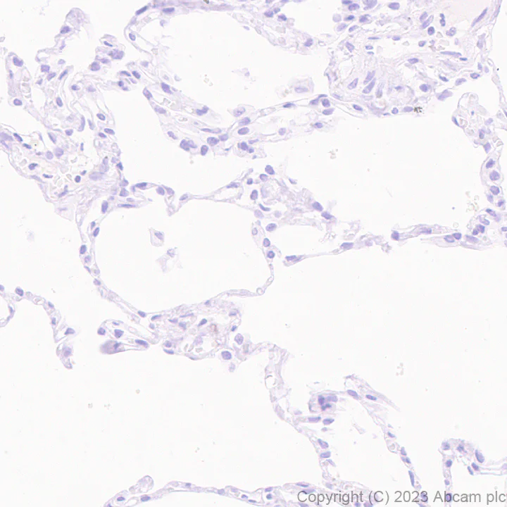 Immunohistochemistry (Formalin/PFA-fixed paraffin-embedded sections) - Antigen Retrieval Buffer (100X Tris-EDTA Buffer, pH 9.0) (AB93684)