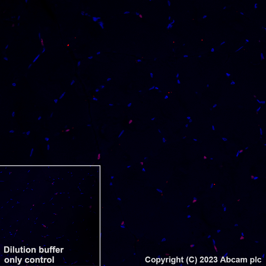 Immunohistochemistry (Formalin/PFA-fixed paraffin-embedded sections) - Antigen Retrieval Buffer (100X Tris-EDTA Buffer, pH 9.0) (AB93684), expandable thumbnail