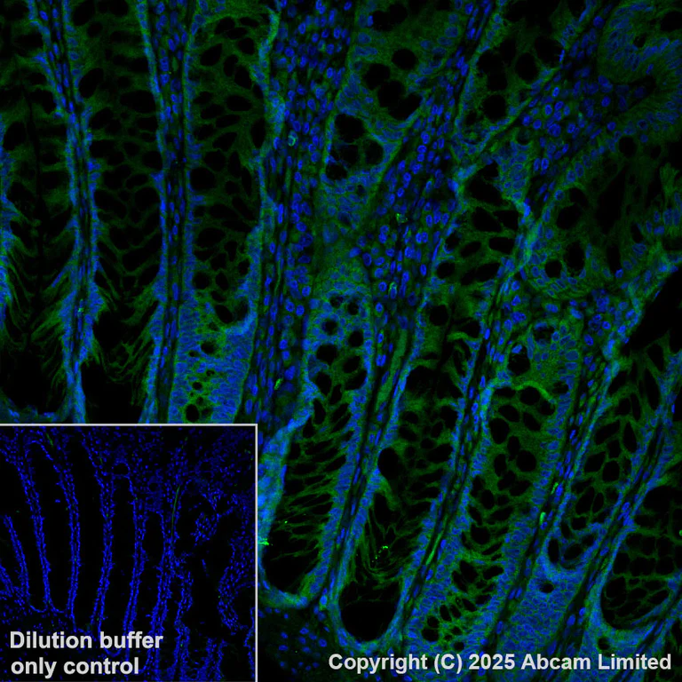 Immunohistochemistry (Formalin/PFA-fixed paraffin-embedded sections) - Antigen Retrieval Buffer (100X Tris-EDTA Buffer, pH 9.0) (AB93684)
