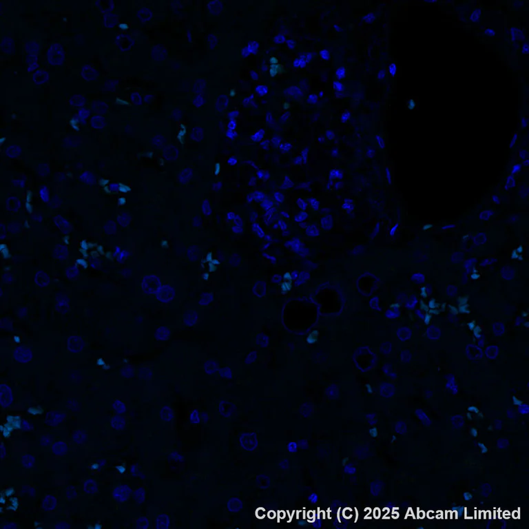 Immunohistochemistry (Formalin/PFA-fixed paraffin-embedded sections) - Antigen Retrieval Buffer (100X Tris-EDTA Buffer, pH 9.0) (AB93684)